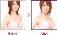 藤井美咲さん Before > After