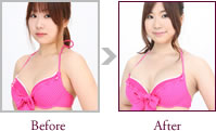 成瀬まりさん Before > After