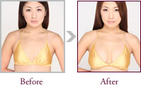 佐々木良子さん Before > After