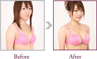 浅田奈緒さん Before > After