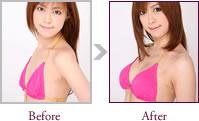 河合つばきさん Before > After