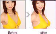 中島美紀さん Before > After