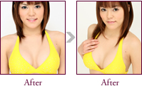 小島綾さん Before > After