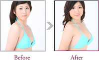 岡本さくらさん Before > After