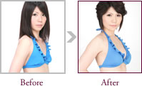 水沢里奈さん Before > After