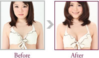 浅田奈緒さん Before > After