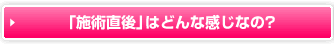 「施術直後」はどんな感じなの？