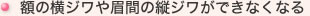 額の横ジワや眉間の縦ジワができなくなる