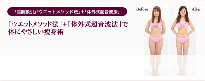 切らない 『脂肪吸引』「ウエットメソッド法」＋「体外式超音波法」「ウエットメソッド法」＋「体外式超音波法」で体にやさしい痩身術