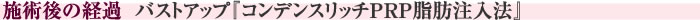 施術後の経過　バストアップ『コンデンスリッチPRP脂肪注入法』