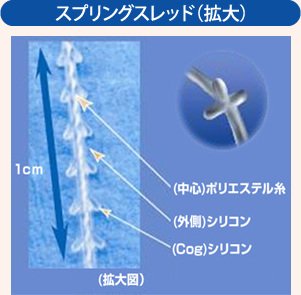 スプリングスレッド（拡大）