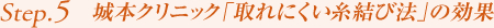 Step5. 城本クリニック「取れにくい糸結び法」の効果