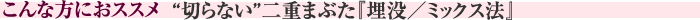 こんな方におススメ　“切らない”二重まぶた『埋没／ミックス法』