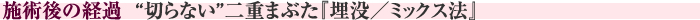 施術後の経過　“切らない”二重まぶた『埋没／ミックス法』