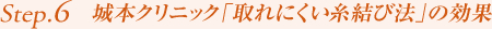 Step6. 城本クリニック「取れにくい糸結び法」の効果