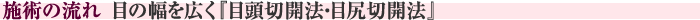 施術の流れ　目の幅を広く『目頭切開法・目尻切開法』