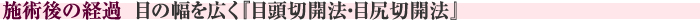 施術後の経過　目の幅を広く『目頭切開法・目尻切開法』