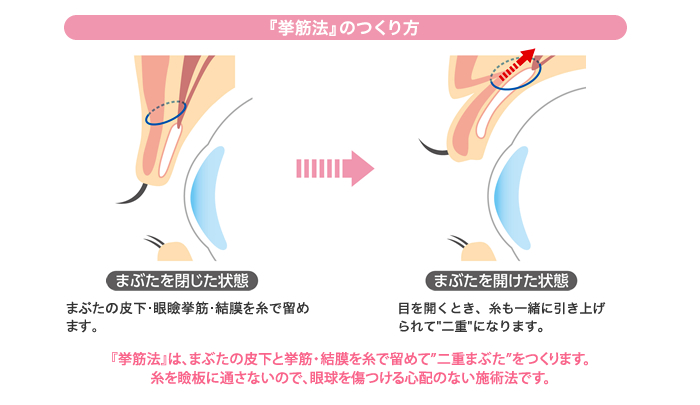 『挙筋法』のつくり方