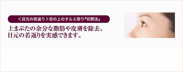 ＜目元の若返り＞目の上のたるみ取り『切開法』　上まぶたの余分な脂肪や皮膚を除去。 目元の若返りを実感できます。