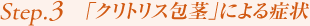 Step3.「クリトリス包茎」による症状