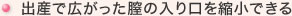 出産で広がった膣の入り口を縮小できる