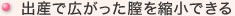 出産で広がった膣を縮小できる