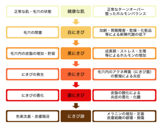 ニキビの種類と進行の状態図