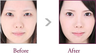 吉岡あやさん Before > After