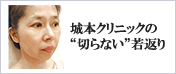 城本クリニックの“切らない”若返り