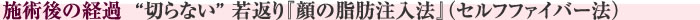 施術後の経過　“切らない” 若返り『顔の脂肪注入法』(セルフファイバー法)