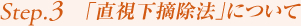 Step3. 「直視下摘除法」について